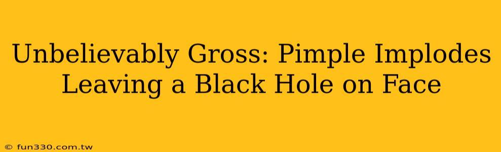 Unbelievably Gross: Pimple Implodes Leaving a Black Hole on Face